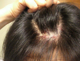 6 Signs That Relaxers Are Damaging Your Hair - OMAKAZI BEAUTY